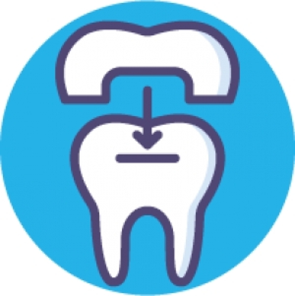 CAD CAM Dentistry